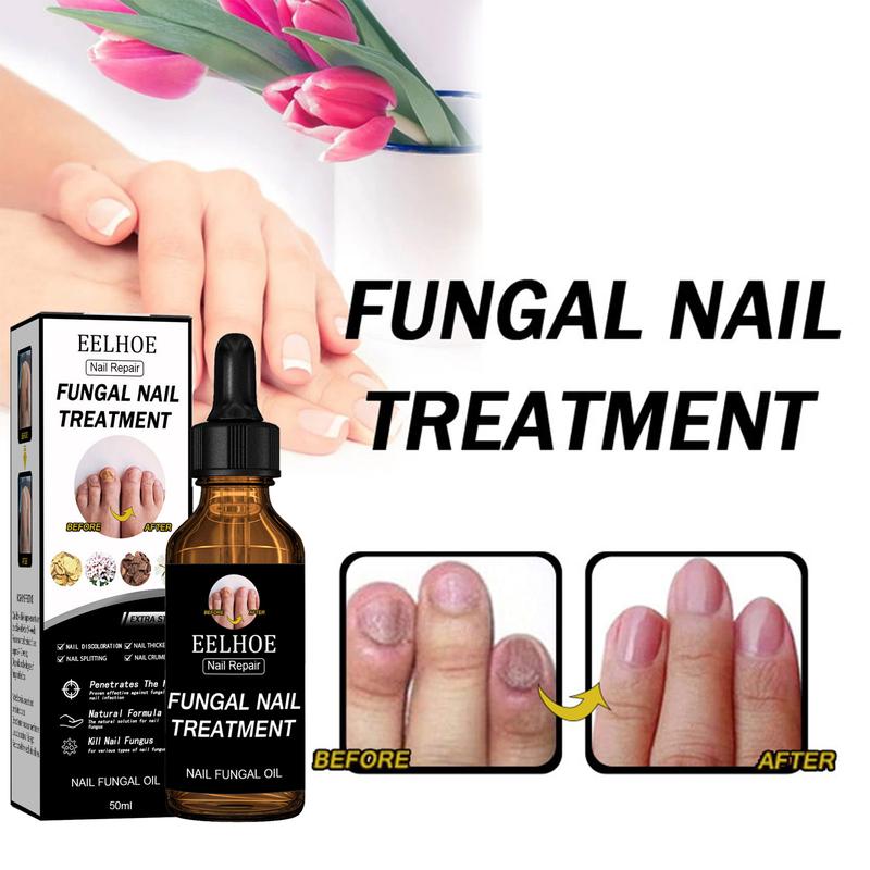 Nail Repair Solution