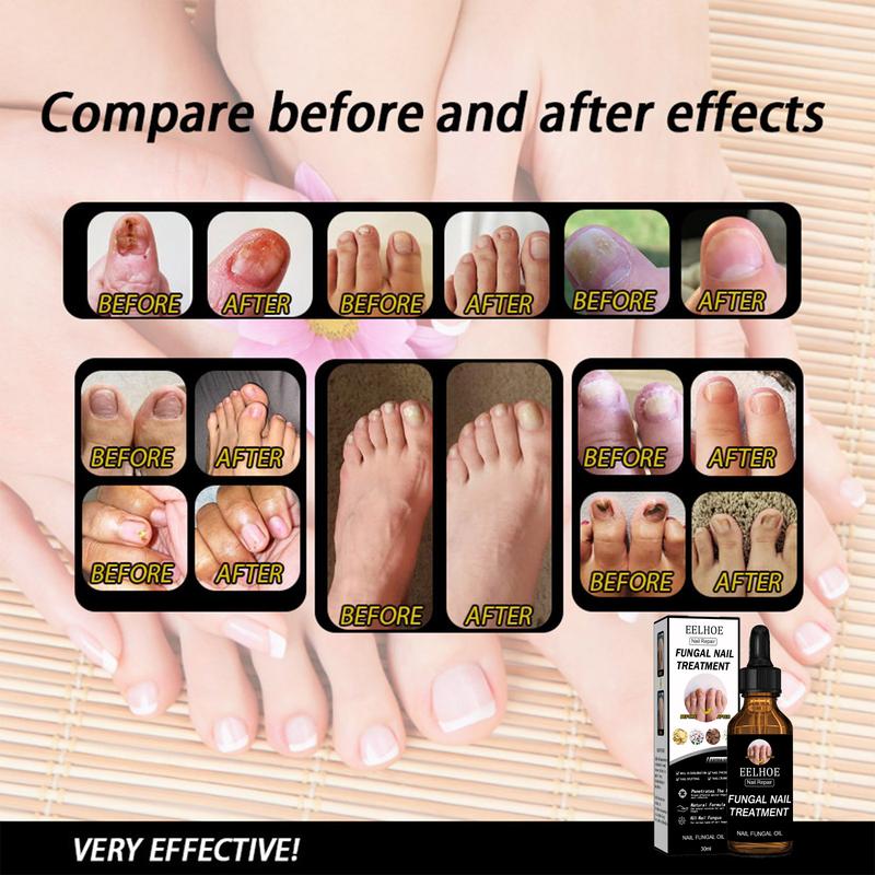 Nail Repair Solution